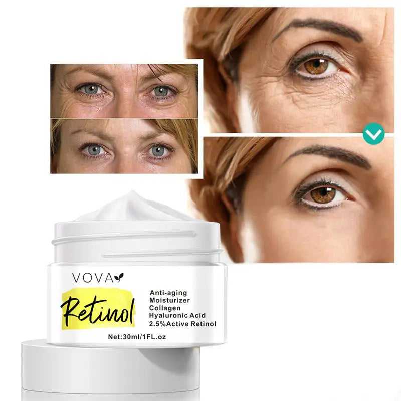 Close-up of Retinol Anti-Aging Moisturizer cream in white jar with yellow label, emphasizing collagen and hyaluronic acid benefits