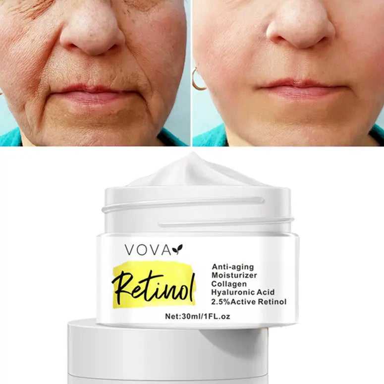 Cream jar of Retinol Anti-Aging Moisturizer with white lid, highlighting collagen and hyaluronic acid, 30ml for skin rejuvenation