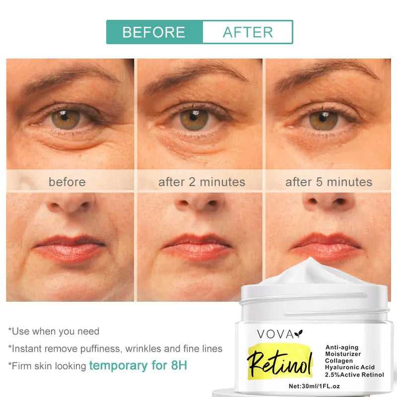 Before and after eye area comparison showing reduced wrinkles after applying Retinol Anti-Aging Moisturizer, 30ml jar visible